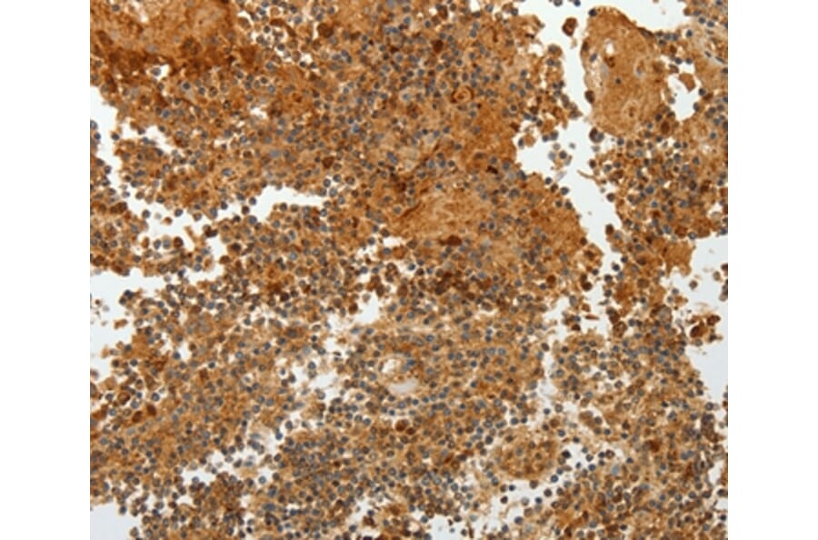 Immunohistochemistry - TFF2 Antibody from Signalway Antibody (35952) - Antibodies.com