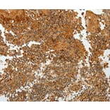 Immunohistochemistry - TFF2 Antibody from Signalway Antibody (35952) - Antibodies.com