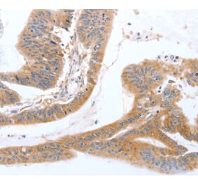 Immunohistochemistry - TGFA Antibody from Signalway Antibody (35957) - Antibodies.com