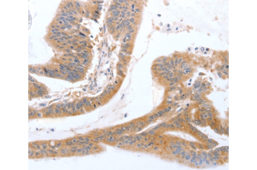 Immunohistochemistry - TGFA Antibody from Signalway Antibody (35957) - Antibodies.com