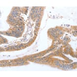 Immunohistochemistry - TGFA Antibody from Signalway Antibody (35957) - Antibodies.com