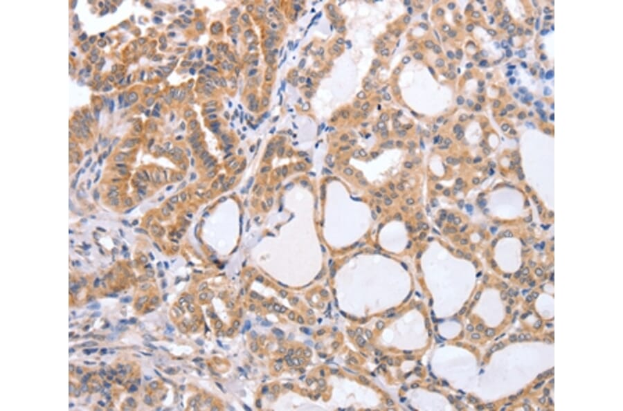 Immunohistochemistry - TGFA Antibody from Signalway Antibody (35957) - Antibodies.com