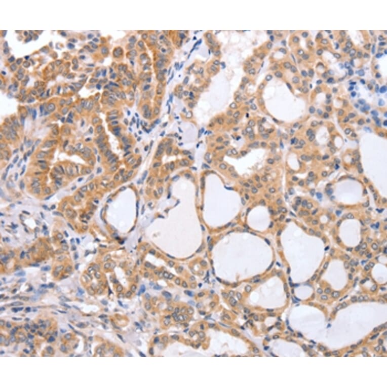 Immunohistochemistry - TGFA Antibody from Signalway Antibody (35957) - Antibodies.com