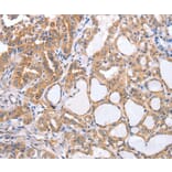 Immunohistochemistry - TGFA Antibody from Signalway Antibody (35957) - Antibodies.com