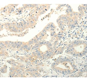 Immunohistochemistry - TPH1 Antibody from Signalway Antibody (35965) - Antibodies.com