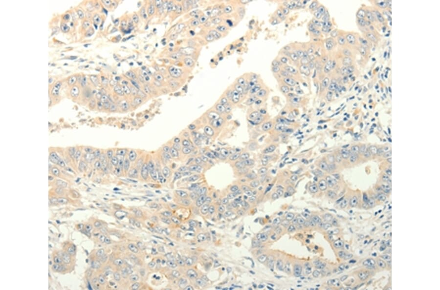Immunohistochemistry - TPH1 Antibody from Signalway Antibody (35965) - Antibodies.com
