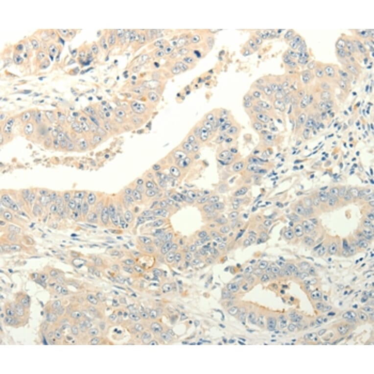 Immunohistochemistry - TPH1 Antibody from Signalway Antibody (35965) - Antibodies.com