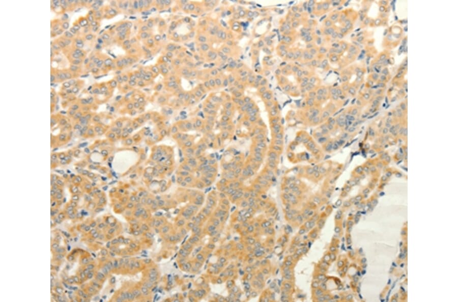 Immunohistochemistry - TPH1 Antibody from Signalway Antibody (35965) - Antibodies.com