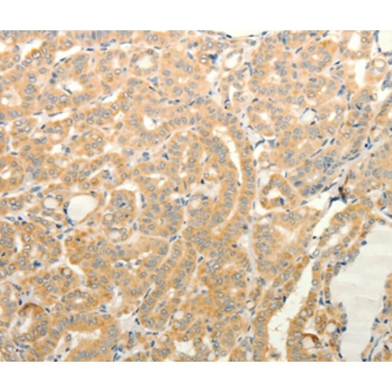 Immunohistochemistry - TPH1 Antibody from Signalway Antibody (35965) - Antibodies.com