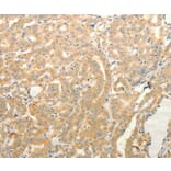 Immunohistochemistry - TPH1 Antibody from Signalway Antibody (35965) - Antibodies.com