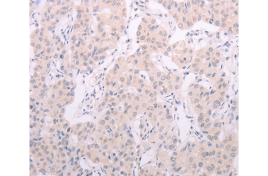 Immunohistochemistry - TSHR Antibody from Signalway Antibody (35980) - Antibodies.com