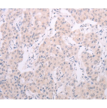 Immunohistochemistry - TSHR Antibody from Signalway Antibody (35980) - Antibodies.com