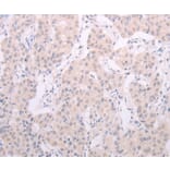 Immunohistochemistry - TSHR Antibody from Signalway Antibody (35980) - Antibodies.com