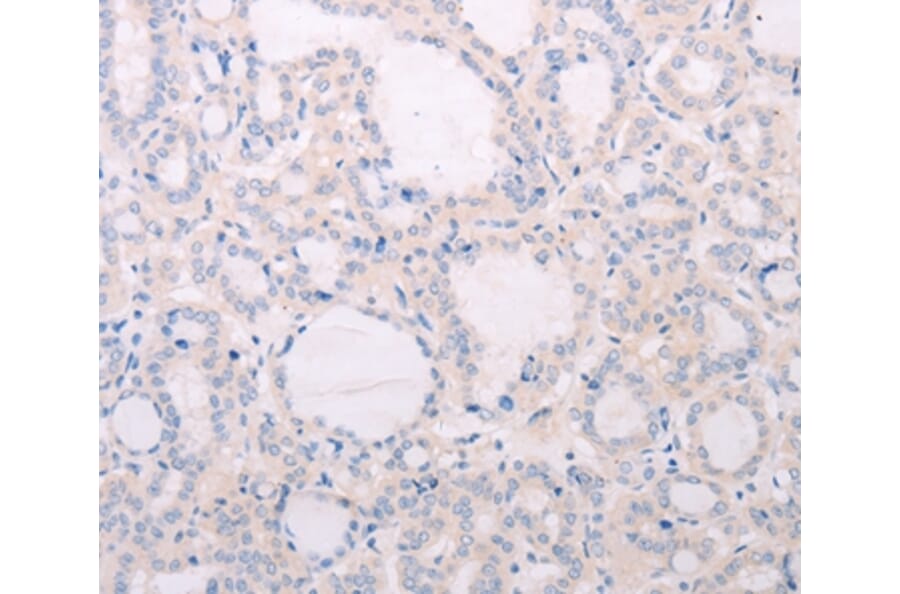 Immunohistochemistry - TSHR Antibody from Signalway Antibody (35980) - Antibodies.com
