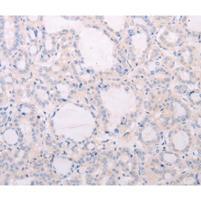 Immunohistochemistry - TSHR Antibody from Signalway Antibody (35980) - Antibodies.com