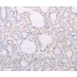 Immunohistochemistry - TSHR Antibody from Signalway Antibody (35980) - Antibodies.com