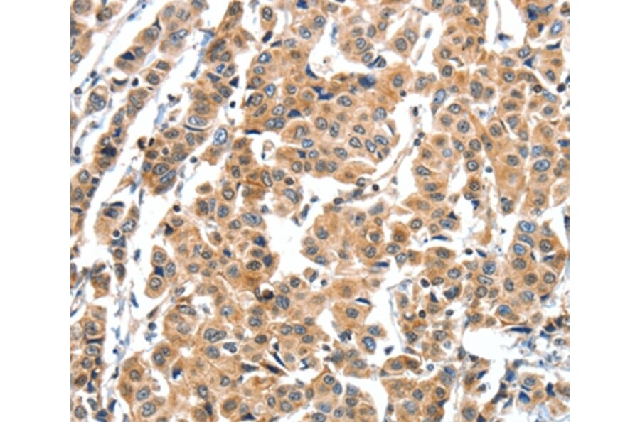 Immunohistochemistry - XBP1 Antibody from Signalway Antibody (35984) - Antibodies.com