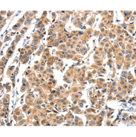 Immunohistochemistry - XBP1 Antibody from Signalway Antibody (35984) - Antibodies.com