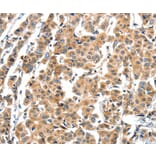 Immunohistochemistry - XBP1 Antibody from Signalway Antibody (35984) - Antibodies.com