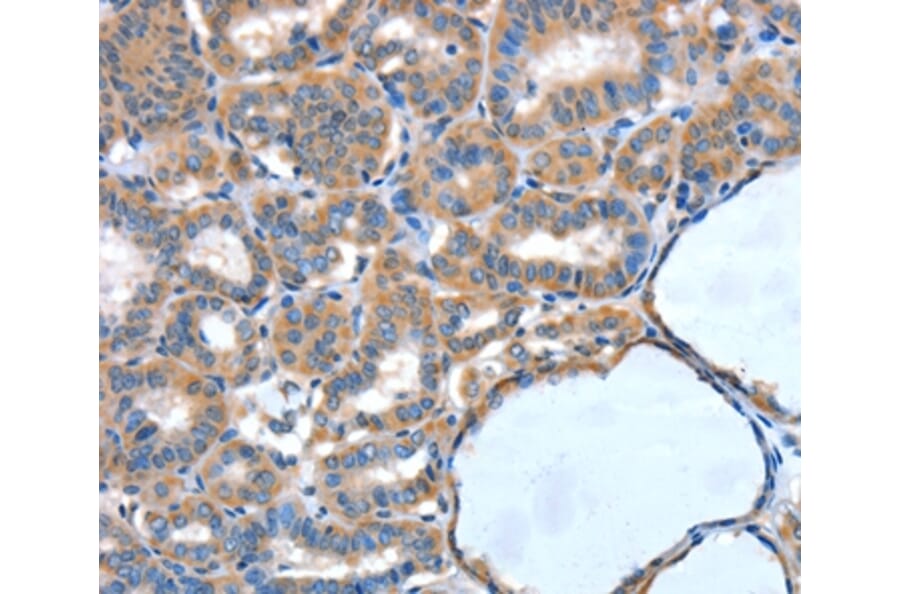 Immunohistochemistry - XBP1 Antibody from Signalway Antibody (35984) - Antibodies.com