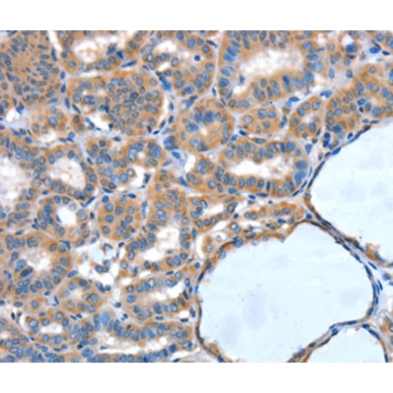 Immunohistochemistry - XBP1 Antibody from Signalway Antibody (35984) - Antibodies.com