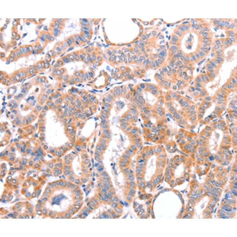 Immunohistochemistry - AOC1 Antibody from Signalway Antibody (36012) - Antibodies.com