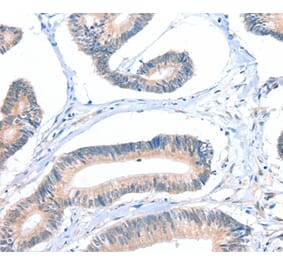 Immunohistochemistry - FHL5 Antibody from Signalway Antibody (36026) - Antibodies.com