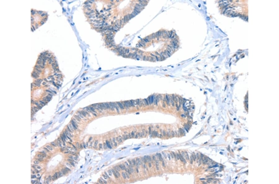 Immunohistochemistry - FHL5 Antibody from Signalway Antibody (36026) - Antibodies.com