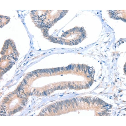 Immunohistochemistry - FHL5 Antibody from Signalway Antibody (36026) - Antibodies.com