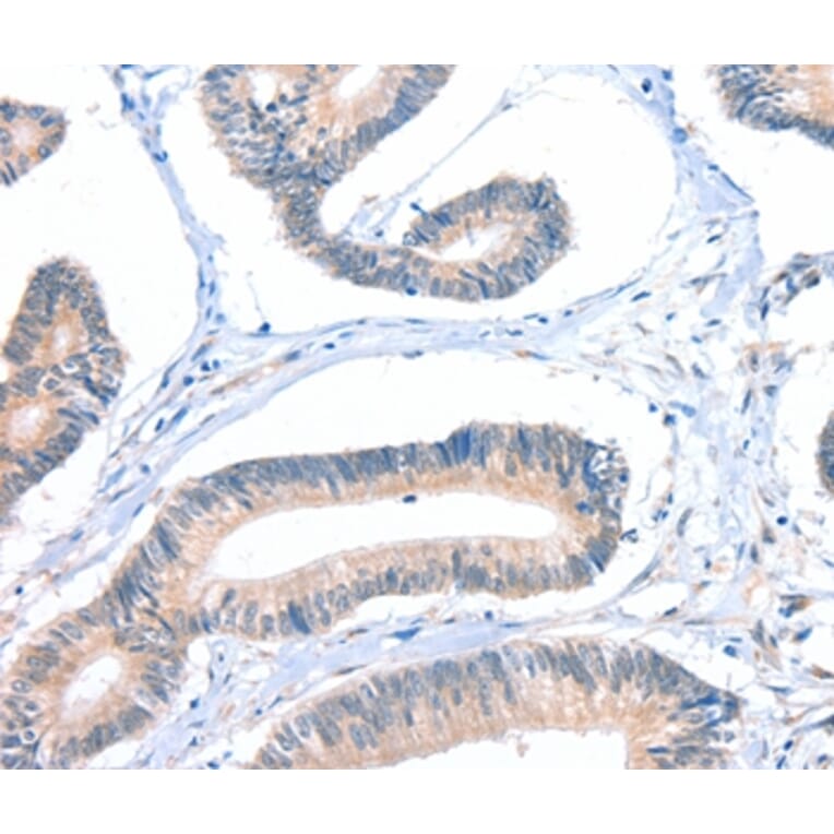 Immunohistochemistry - FHL5 Antibody from Signalway Antibody (36026) - Antibodies.com