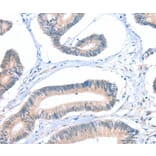 Immunohistochemistry - FHL5 Antibody from Signalway Antibody (36026) - Antibodies.com