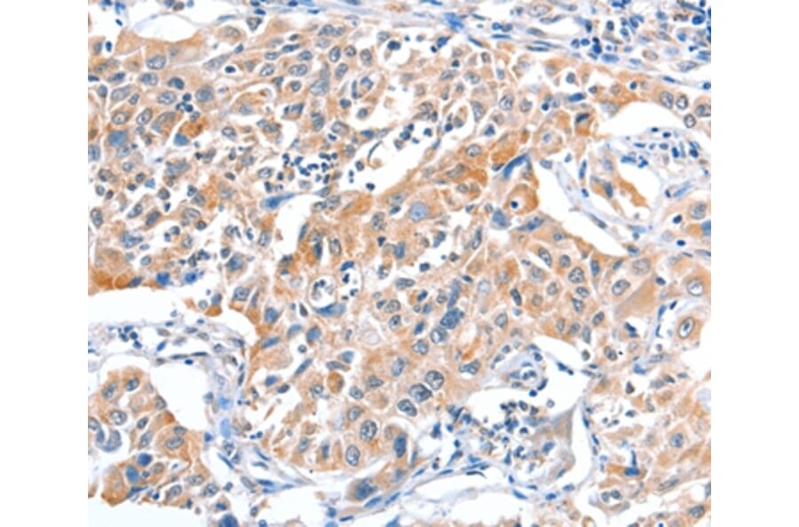 Immunohistochemistry - FHL5 Antibody from Signalway Antibody (36026) - Antibodies.com
