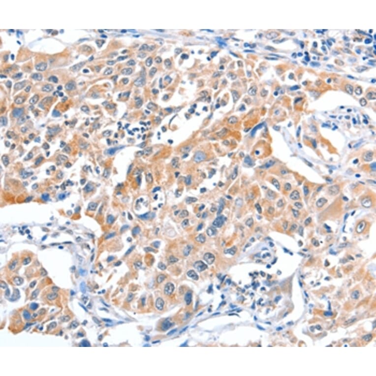Immunohistochemistry - FHL5 Antibody from Signalway Antibody (36026) - Antibodies.com
