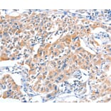 Immunohistochemistry - FHL5 Antibody from Signalway Antibody (36026) - Antibodies.com