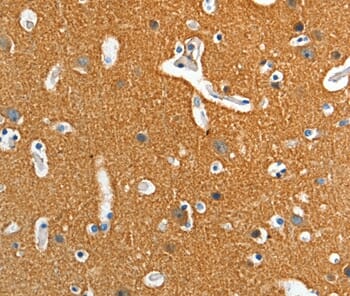 Immunohistochemical analysis of paraffin-embedded Human brain tissue using #36050 at dilution 1/15.