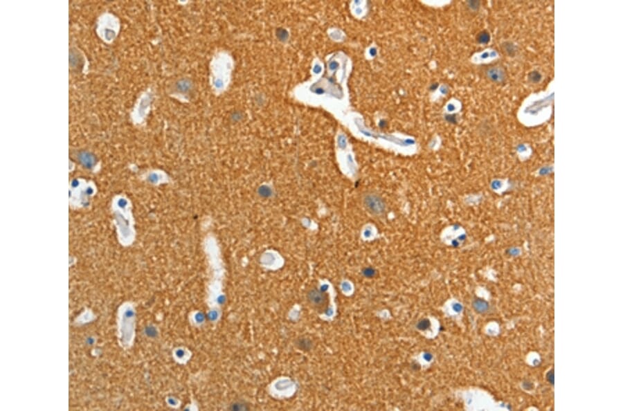Immunohistochemistry - ADD2 Antibody from Signalway Antibody (36050) - Antibodies.com