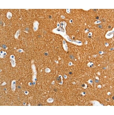 Immunohistochemistry - ADD2 Antibody from Signalway Antibody (36050) - Antibodies.com