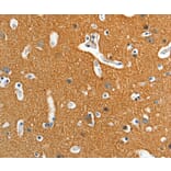 Immunohistochemistry - ADD2 Antibody from Signalway Antibody (36050) - Antibodies.com
