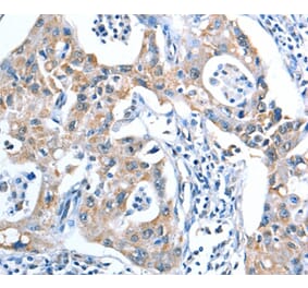 Immunohistochemistry - ADSL Antibody from Signalway Antibody (36051) - Antibodies.com