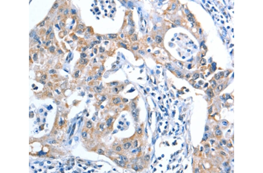 Immunohistochemistry - ADSL Antibody from Signalway Antibody (36051) - Antibodies.com