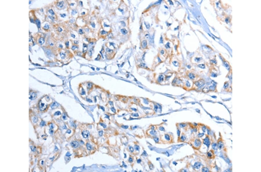 Immunohistochemistry - ADSL Antibody from Signalway Antibody (36051) - Antibodies.com