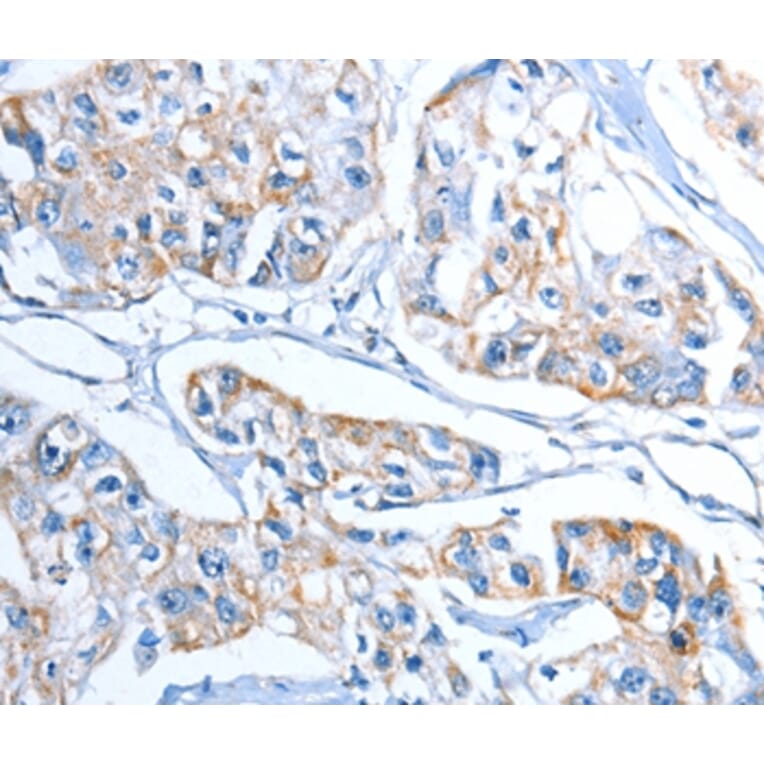 Immunohistochemistry - ADSL Antibody from Signalway Antibody (36051) - Antibodies.com