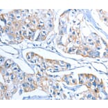 Immunohistochemistry - ADSL Antibody from Signalway Antibody (36051) - Antibodies.com