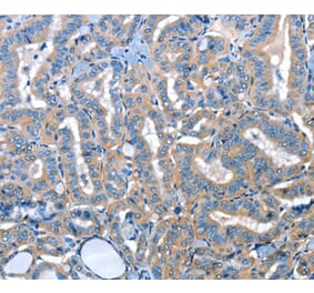 Immunohistochemistry - ADH4 Antibody from Signalway Antibody (36052) - Antibodies.com