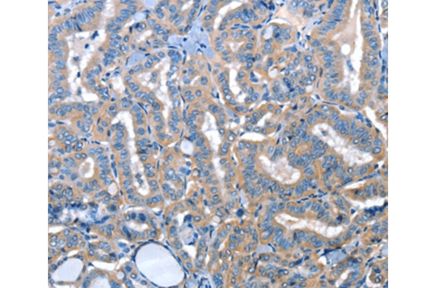 Immunohistochemistry - ADH4 Antibody from Signalway Antibody (36052) - Antibodies.com