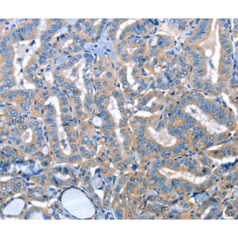 Immunohistochemistry - ADH4 Antibody from Signalway Antibody (36052) - Antibodies.com