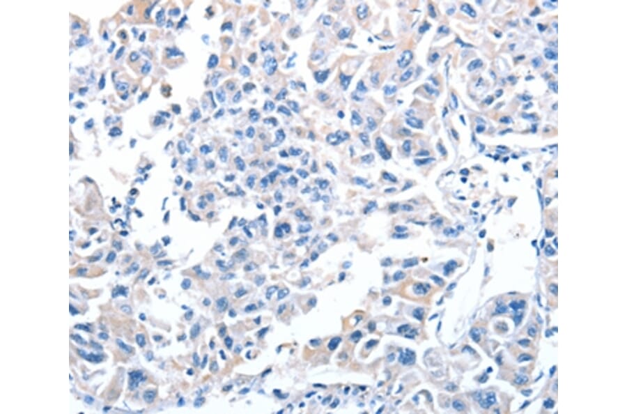 Immunohistochemistry - ADH4 Antibody from Signalway Antibody (36052) - Antibodies.com