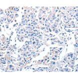 Immunohistochemistry - ADH4 Antibody from Signalway Antibody (36052) - Antibodies.com