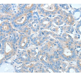 Immunohistochemistry - AGO2 Antibody from Signalway Antibody (36062) - Antibodies.com