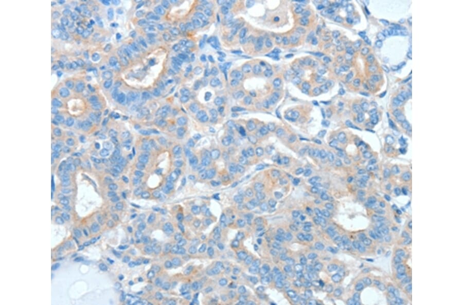 Immunohistochemistry - AGO2 Antibody from Signalway Antibody (36062) - Antibodies.com